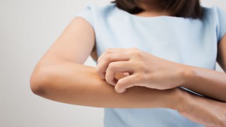 Eine junge Frau kratzt sich am rechten Unterarm
