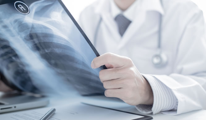 Ein Arzt betrachtet das Röntgenbild einer Lunge
