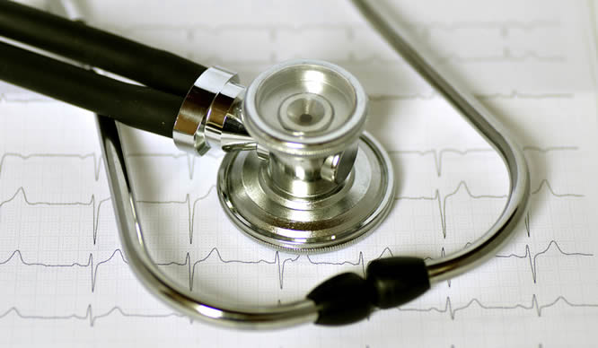 Ein Stethoskop liegt auf einem Kardiogramm